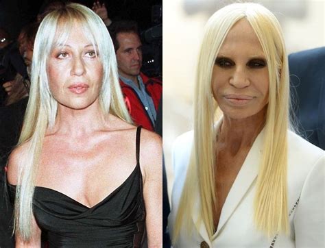 donatella versace cirugia|donatella versace without plastic surgery.